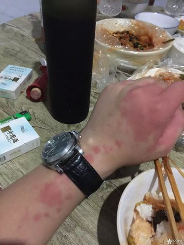 喝红酒牙齿痛