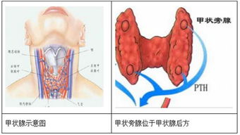 腺肌症患者可以喝红酒吗