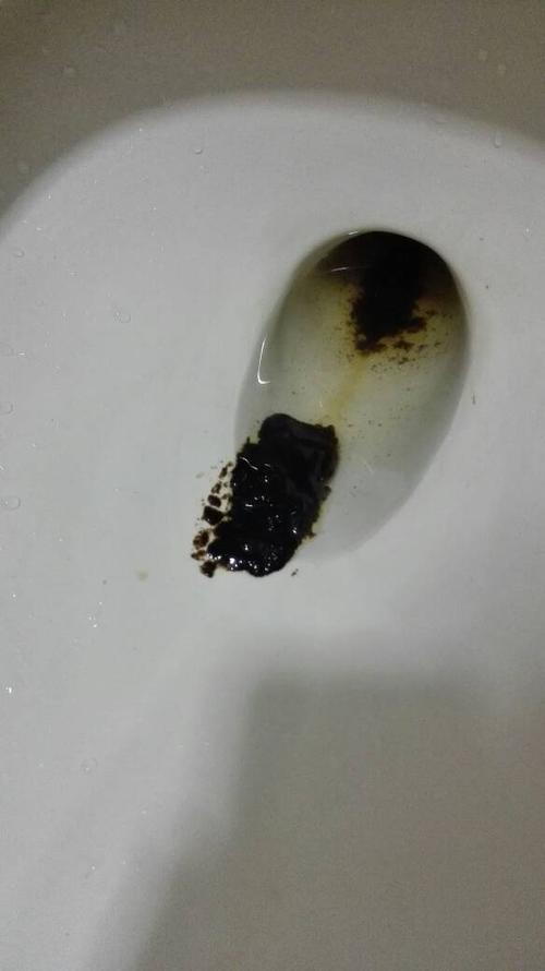 红酒喝完便便变黑色