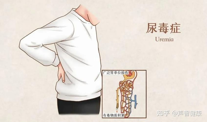尿毒症早期的三大信号